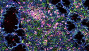 Penn Researchers Use Unique Imaging Technology to Map Cells Tied to Inflammatory Bowel Disease