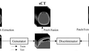 Development of AI technology for producing CT images based on MRI