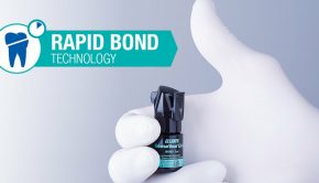Rapid bond technology: Delivering fast-acting, long-lasting bonds