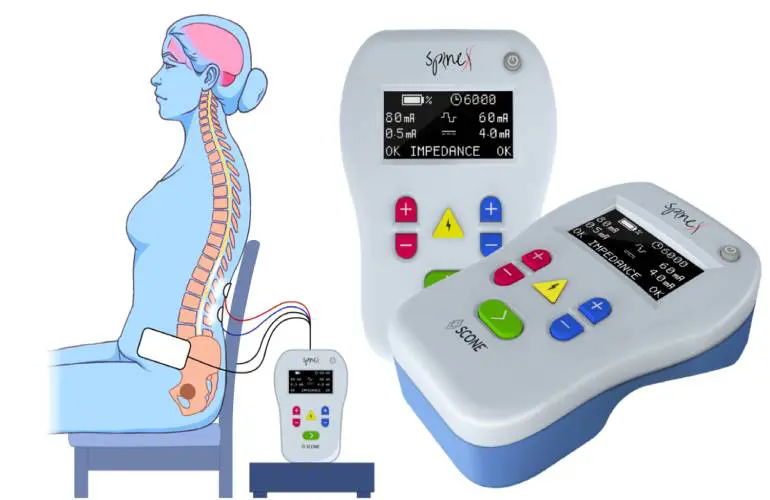 SpineX enrolls first patient in spinal neuromodulation technology trial