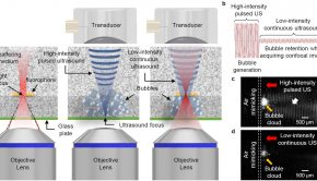 Medical optical imaging using the world's first 'ultrasound-induced tissue transparency' technology