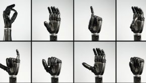 Ability Hand – a revolution in bionic technology