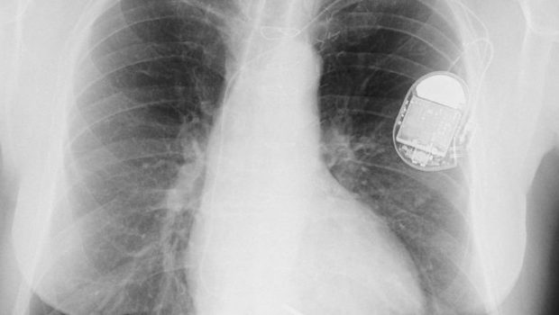 Critical flaw lets hackers control lifesaving devices implanted inside patients