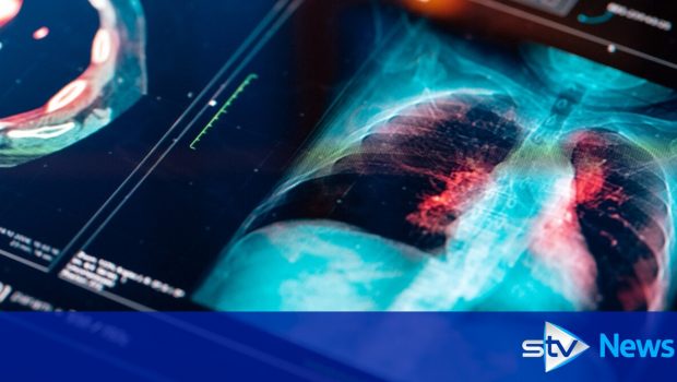 AI technology could help ease winter pressures on NHS, say researchers
