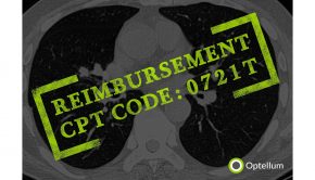 CMS Assigns New Technology Payment Classification for Optellum's Lung Cancer Prediction Score
