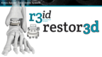 Celebrating Major Milestones in Personalized Orthopaedics, restor3d Announces First Surgery Using the Next Generation Kinos Axiom® Total Ankle System Featuring TIDAL Technology™ and Launches Mobile Companion App of r3id Personalized Surgery Platform