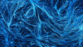 How microglia contribute to Alzheimer’s disease | MIT News