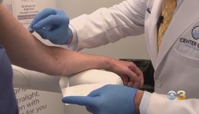 New Technology Changing How Doctors Diagnose Skin Cancer Without Painful Biopsies – CBS Philly