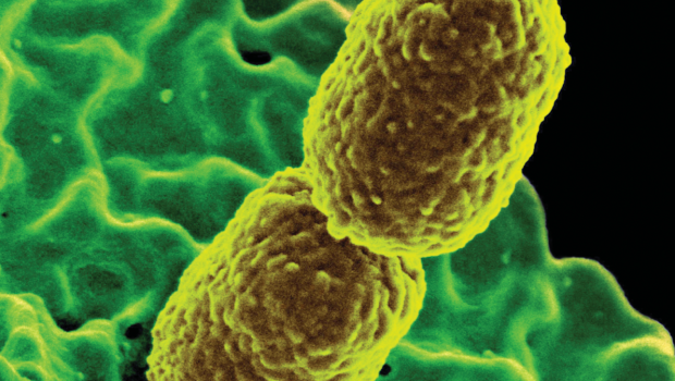 New Technology Enables Differentiation of Bacterial and Viral Infections