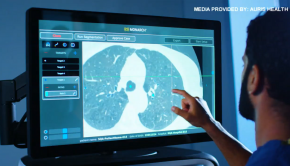 New robotic technology at UC Medical Center to diagnose lung cancer sooner - WKRC TV Cincinnati