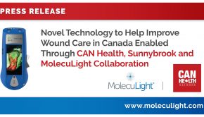 Novel Technology to Help Improve Wound Care in Canada Enabled Through CAN Health, Sunnybrook and MolecuLight Collaboration