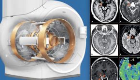 Overview of MRI market and technology trends