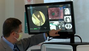 Penn State Health new technology detecting early stages of lung cancer