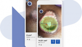 Swift Medical raises $35M to break silence around wound care technology | 2021-08-06