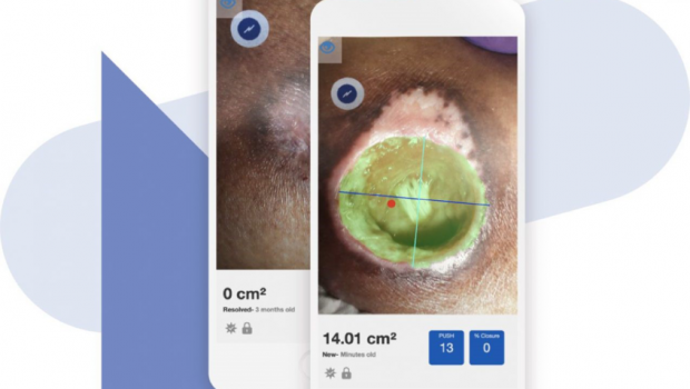 Swift Medical raises $35M to break silence around wound care technology | 2021-08-06
