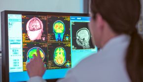 Technology: Brain stimulation can rewire, heal damage