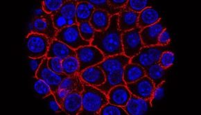 The Metabolic Interactions That Make Pancreatic Tumor Cells Grow