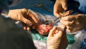 The US organ transplant network is built on shaky technology, reports say