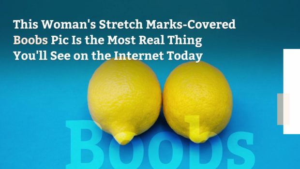 This Woman's Stretch Marks-Covered Boobs Pic Is the Most Real Thing You'll See on the Internet Today