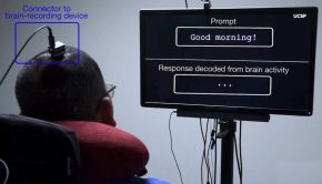 UCSF brain technology gives nonverbal paralysis patient speech