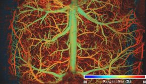 Ultrafast Imaging Reveals Brain Activity in Unprecedented Detail