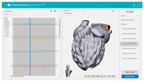 Vektor Medical Receives FDA Clearance for vMap™, First Technology Designed to Identify Arrhythmia Hot Spots Anywhere in Heart in Minutes Using Only ECG Data